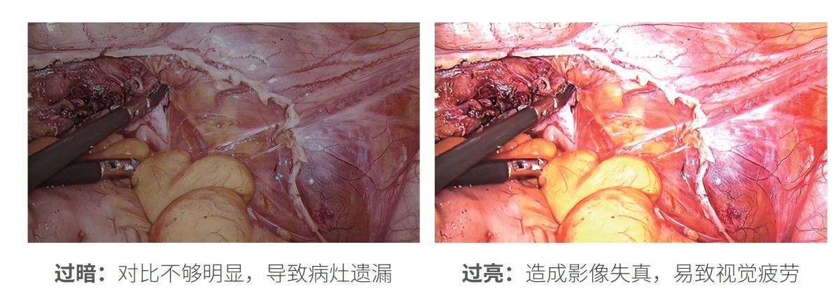 32英寸医用监视器